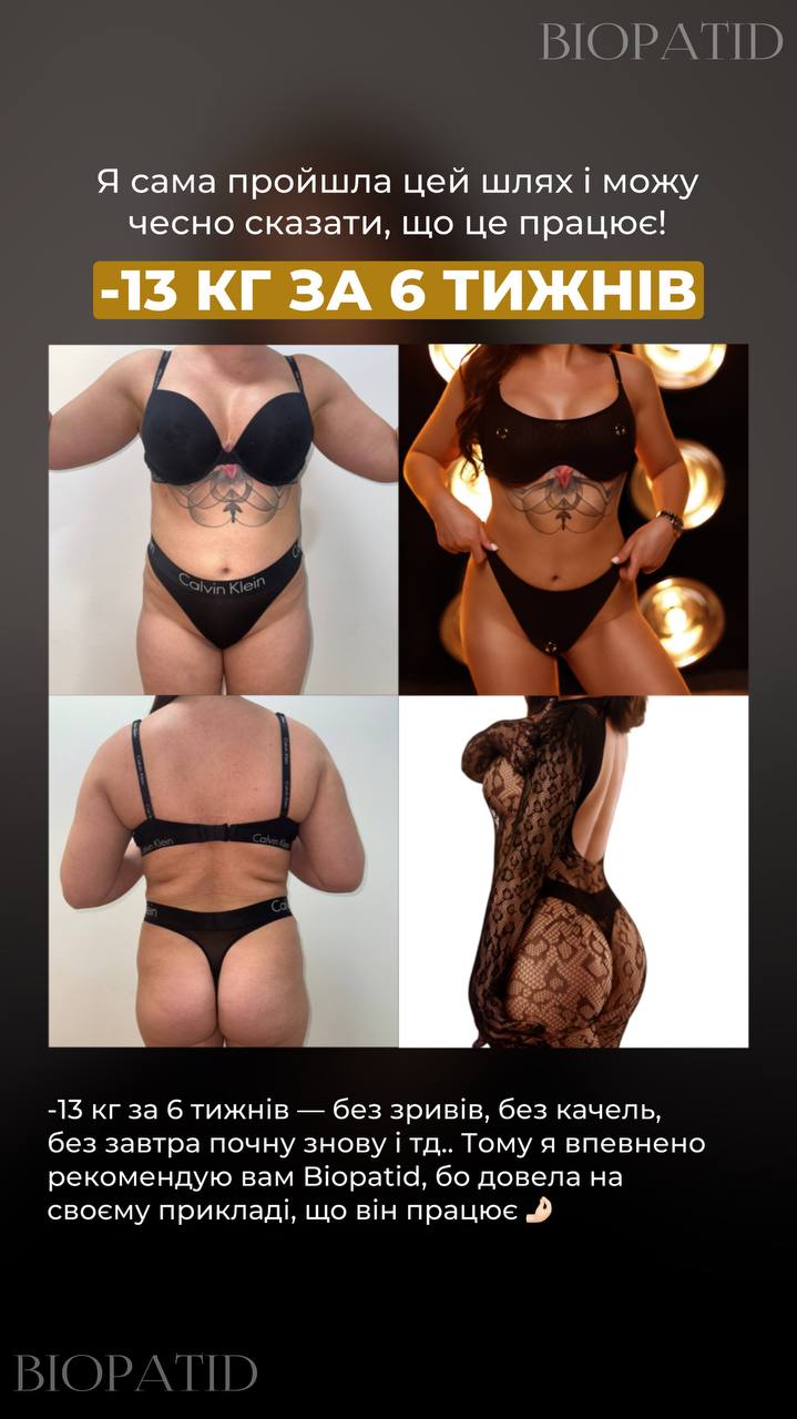 -13 kg