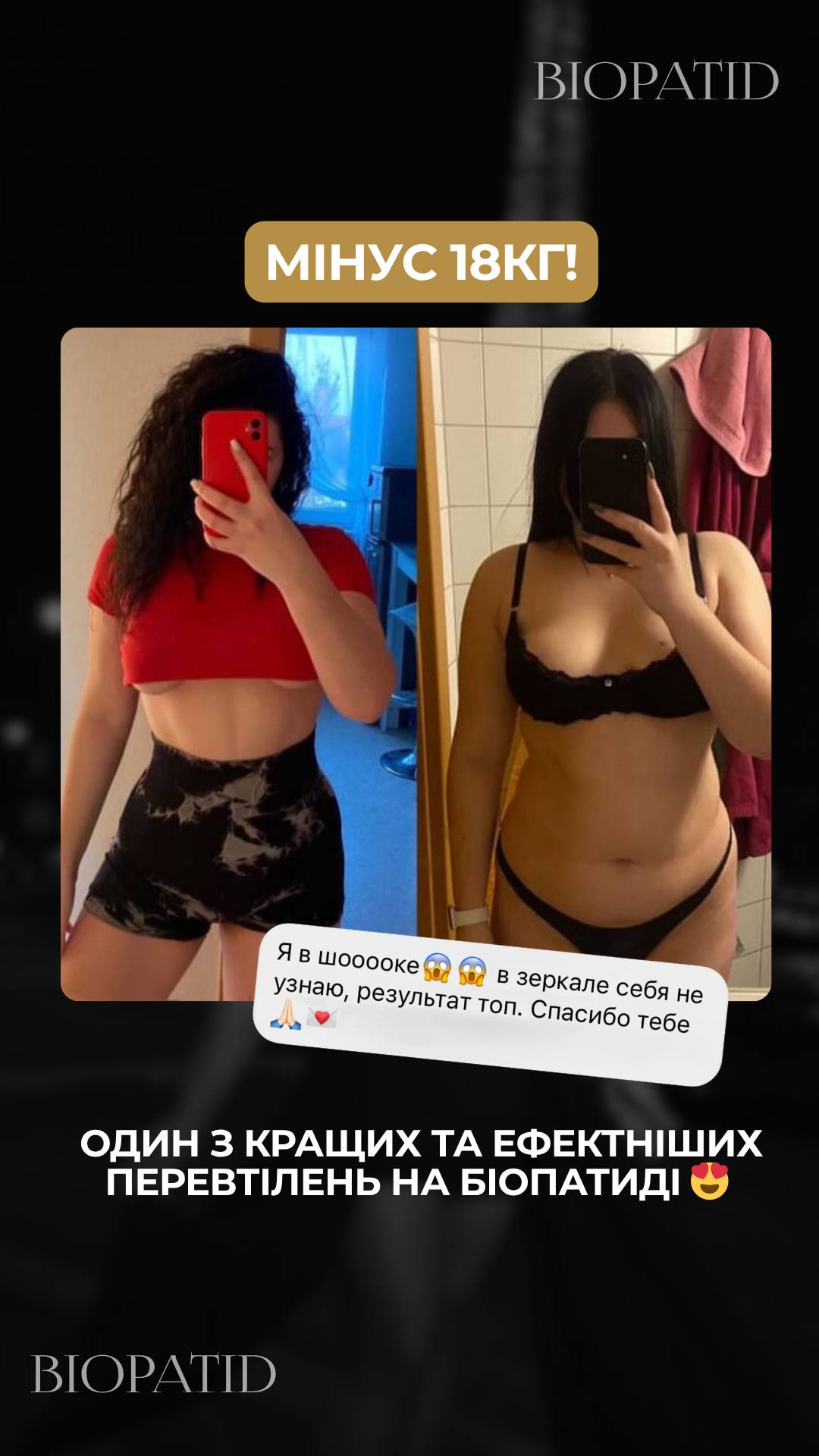 -18 kg
